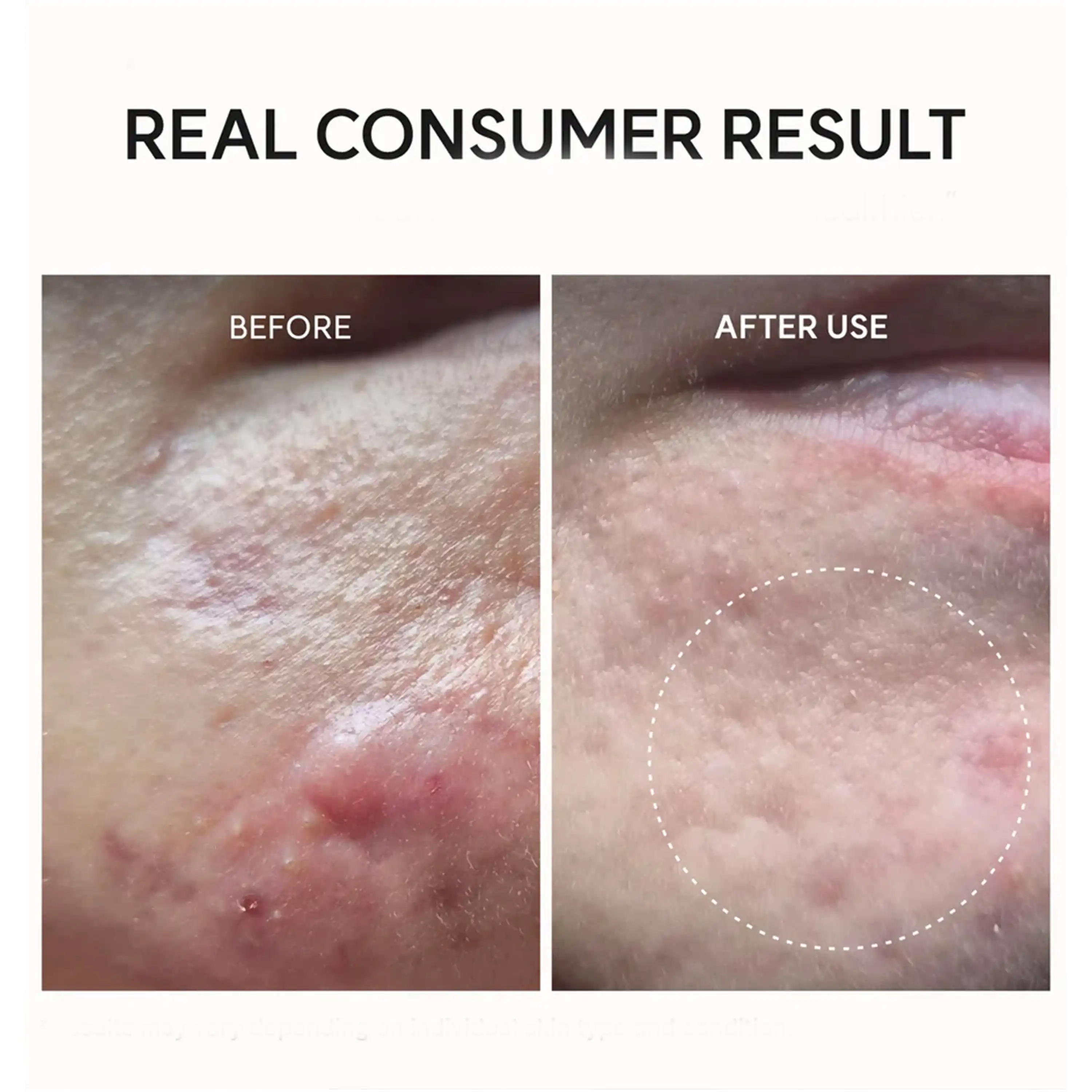 خرید و قیمت گليكوليک اسيد بوسترشات آرنسيا Arencia Glycolic Acid Booster