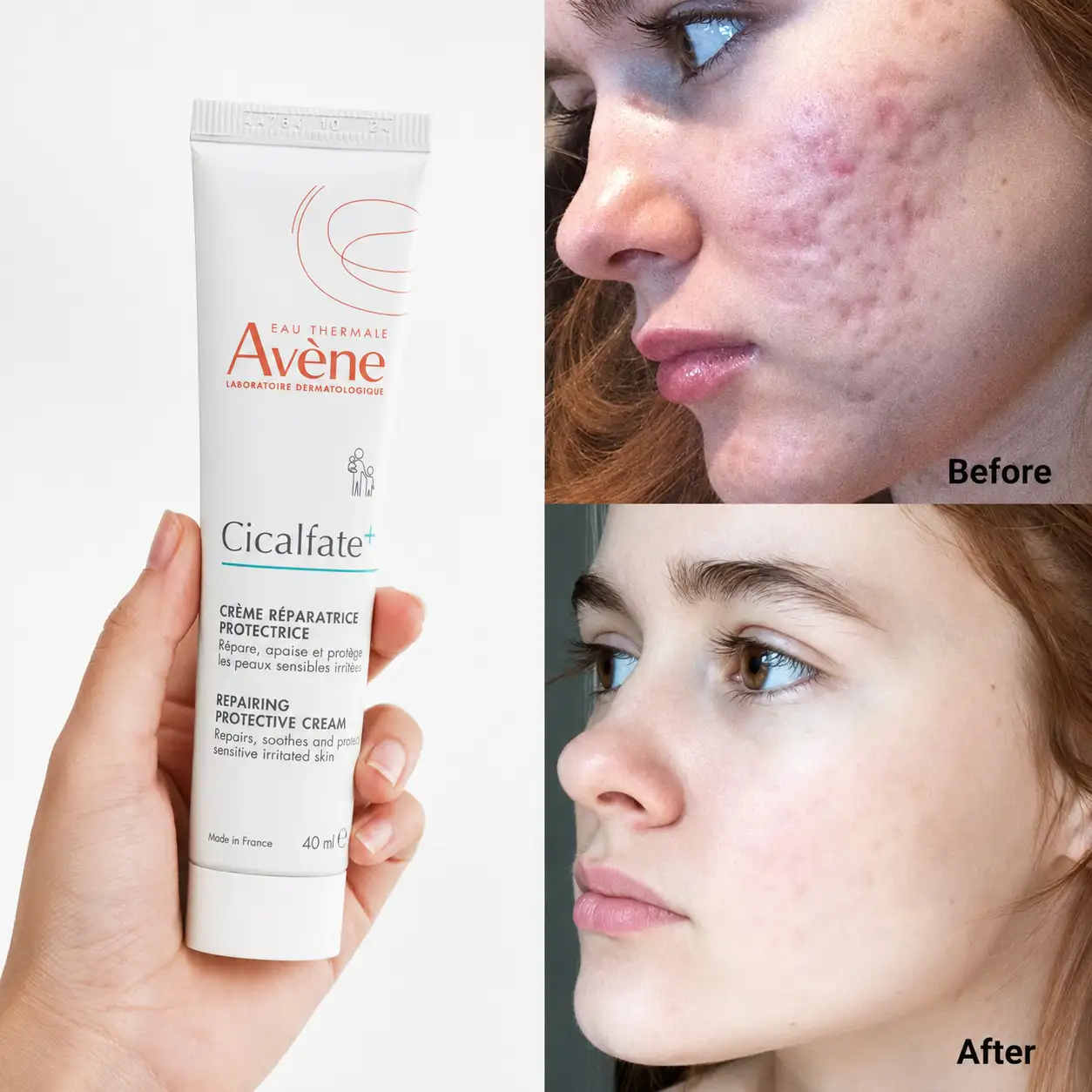 خرید و قیمت كرم بازسازی كننده سيكالفيت Avene Cicalfate Repairing Protective Cream 40ml