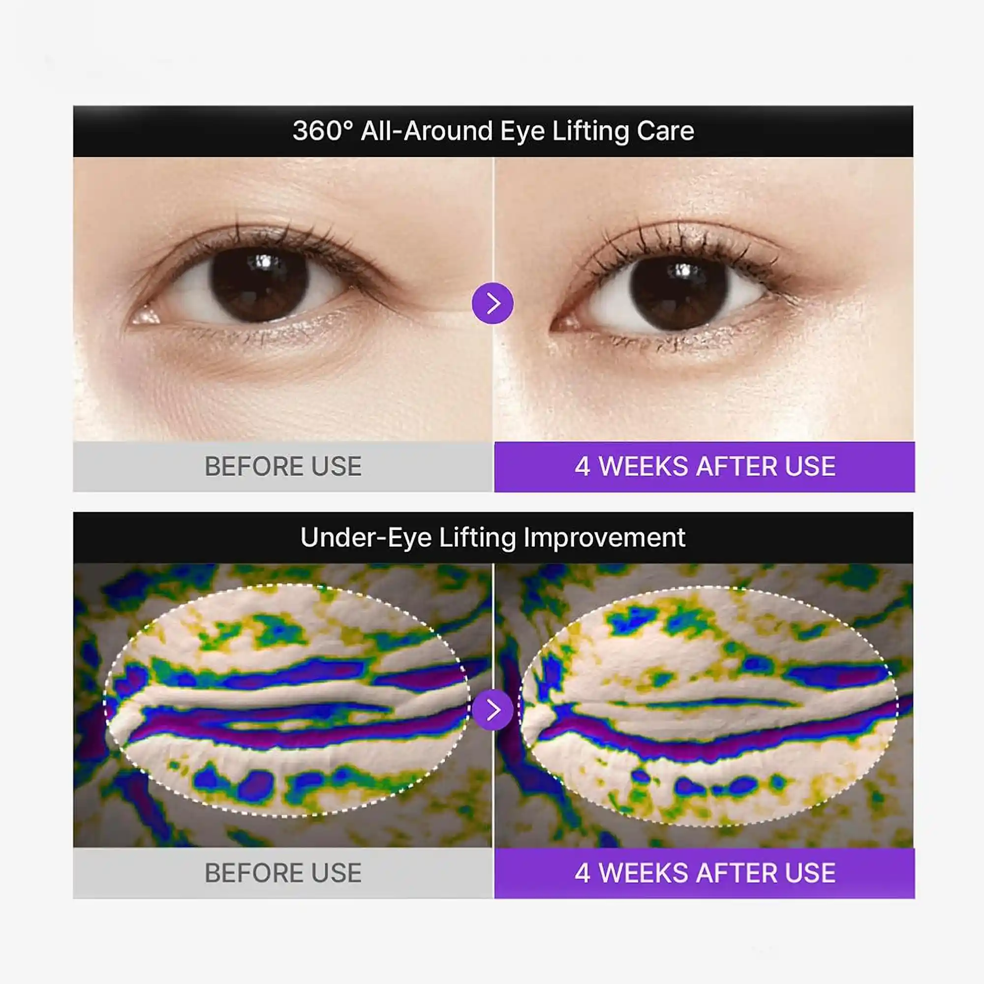 خرید و قیمت كرم دور چشم جوانساز سنتليان Centellian Pdrn Lifting Eye Cream 30ml