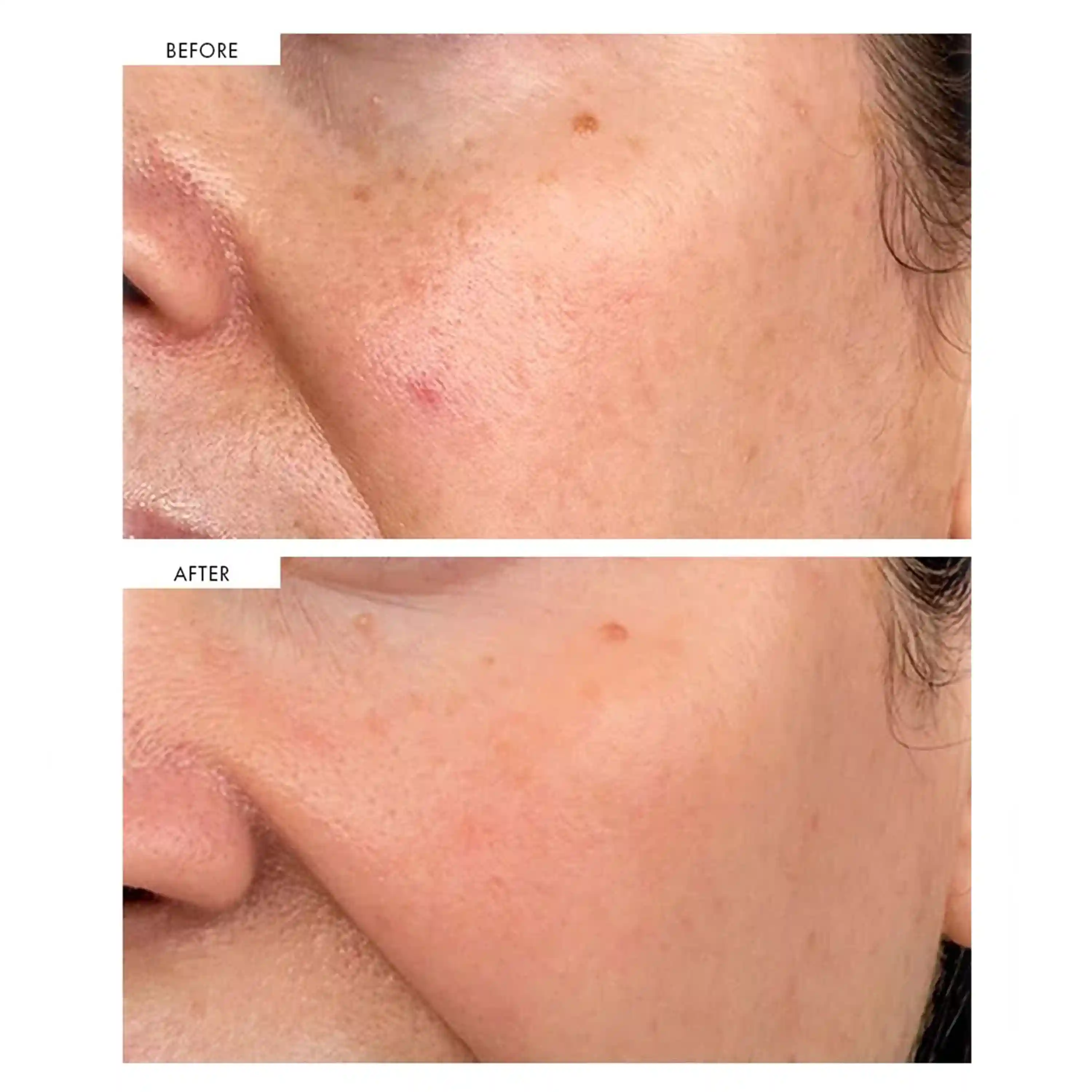 خرید و قیمت ست ضد لک كلينيک Clinique Skin School Even Tone Essentials