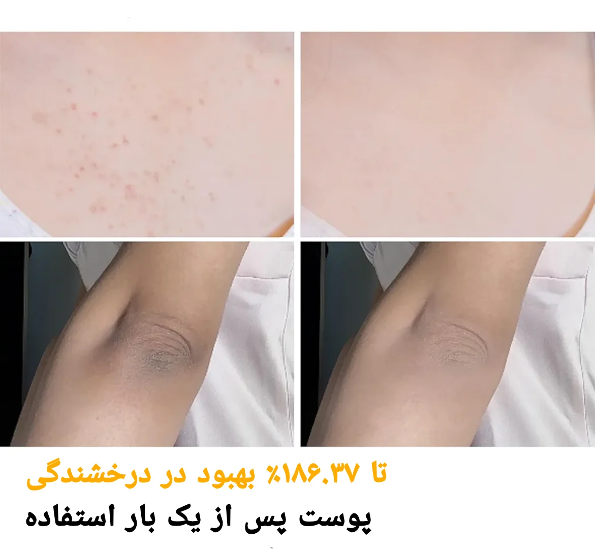 خرید و قیمت پيل شات دكتر ملكسين ترمريک Dr Melaxin Peel Shot Turmeric Spray