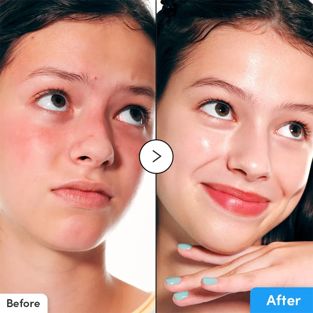 خرید و قیمت سرم آبرسان Eqqual Berry Hyaltoin Flooding Serum 30ml
