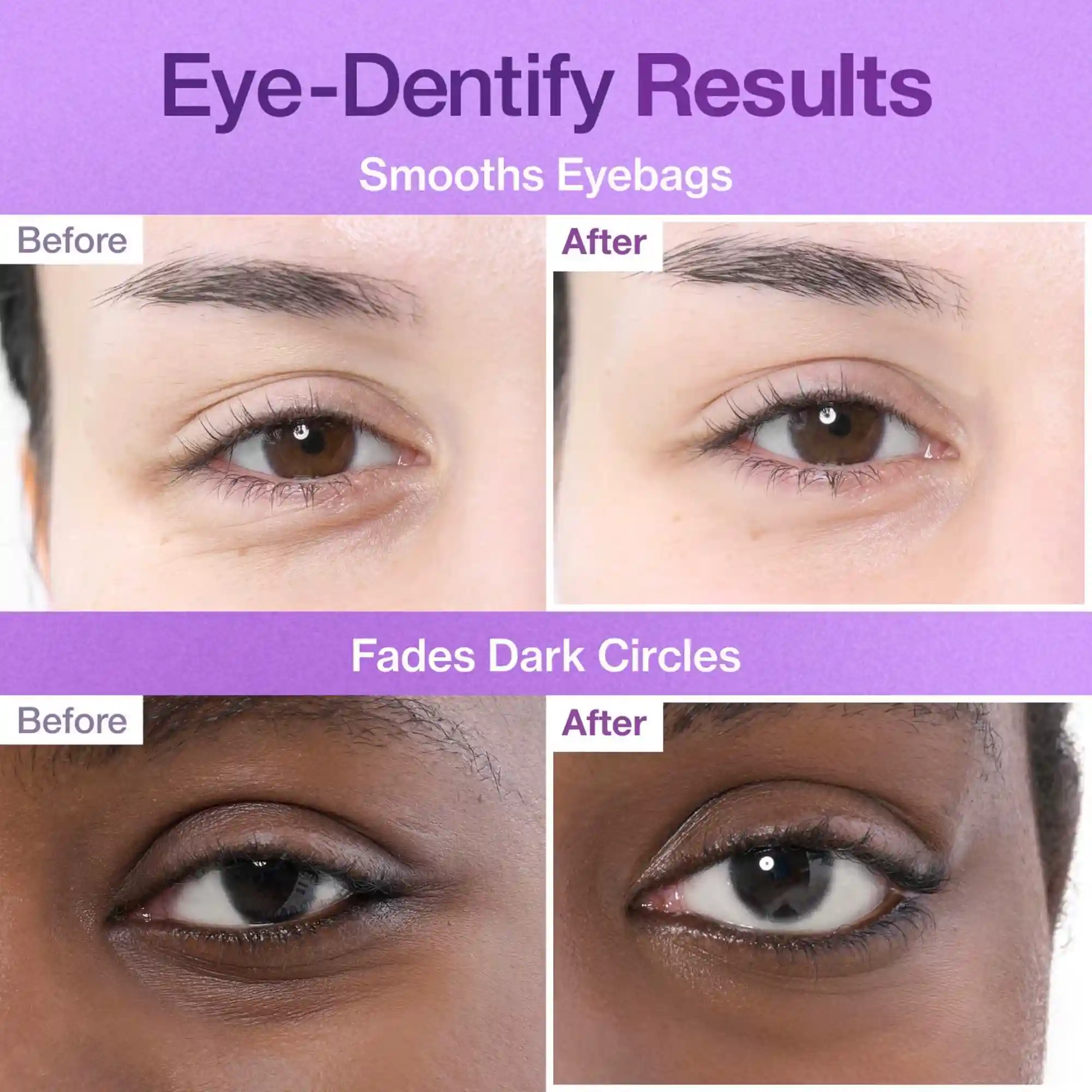 خرید و قیمت پچ زير چشم نامبوزين Numbuzin Collagen Under Eye Patches
