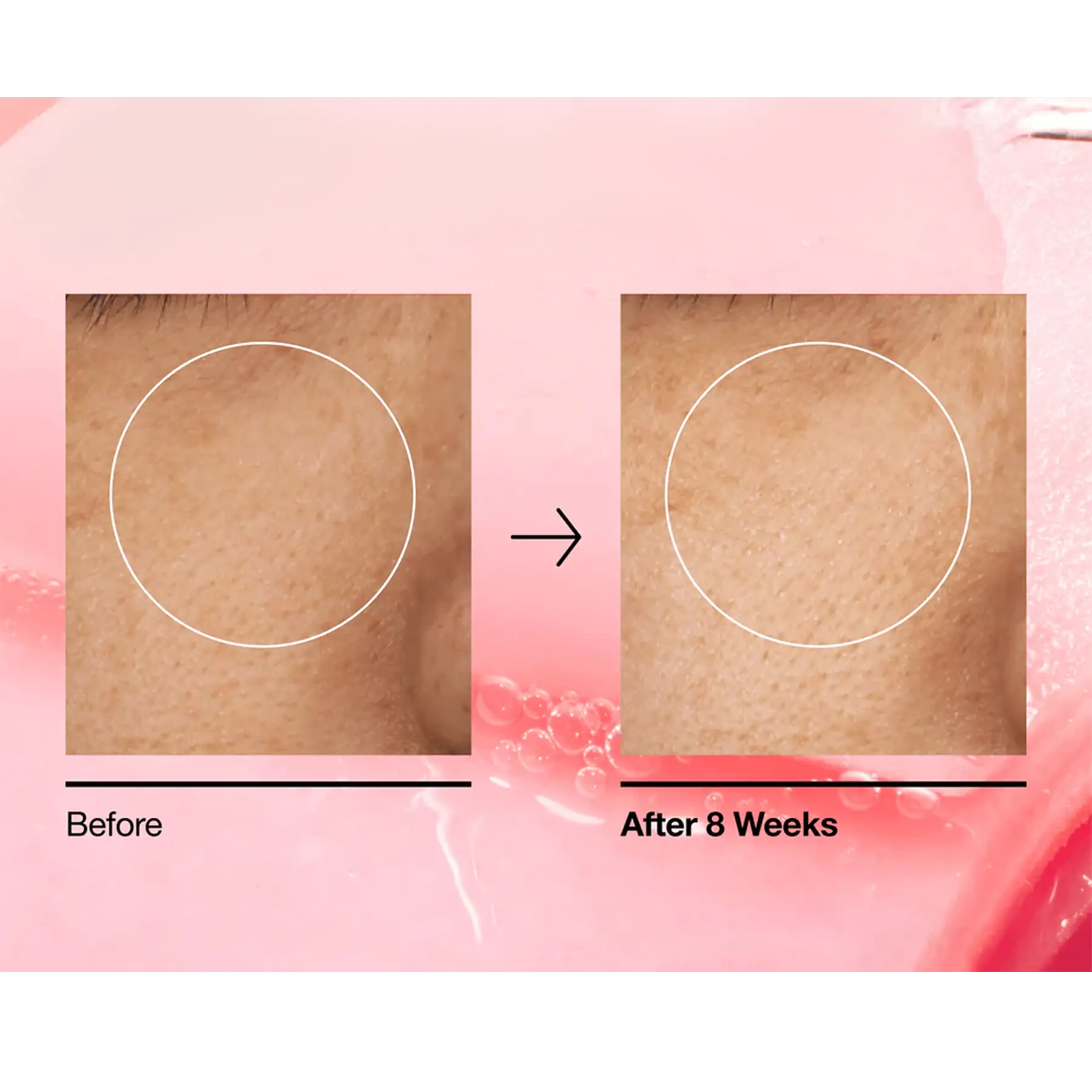 خرید و قیمت پد درخشان كننده آنوا Anua Glow Pad Brightening 60 Pads